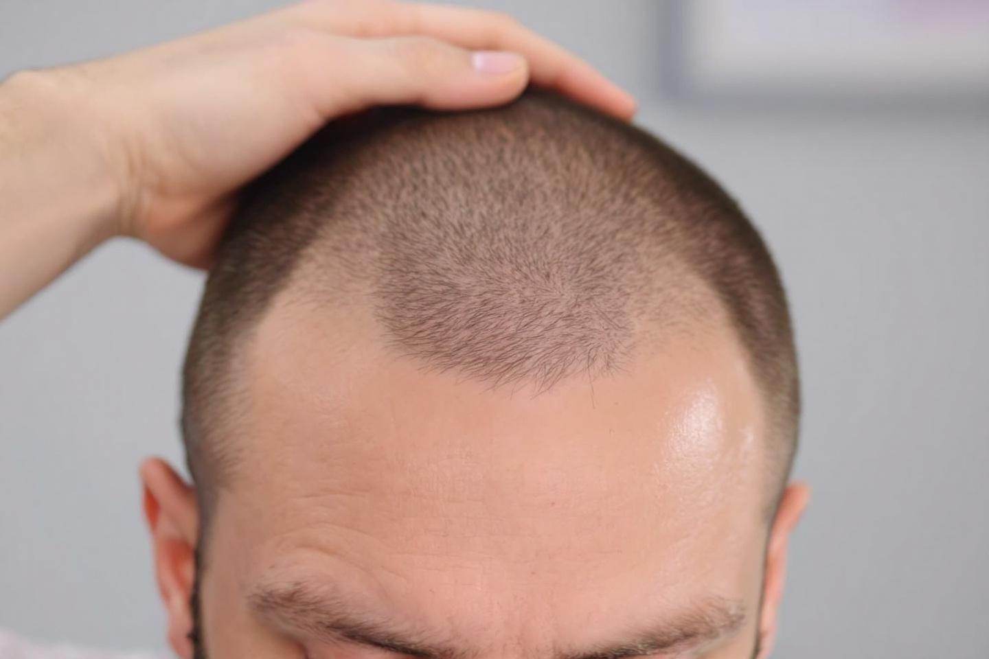 Ondulations wavy sans chaleur : le guide ultime pour cheveux mi-longs